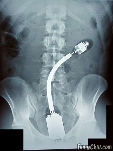 x-rays-02.jpg